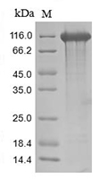 The SDS-PAGE of Recombinant Human CD22